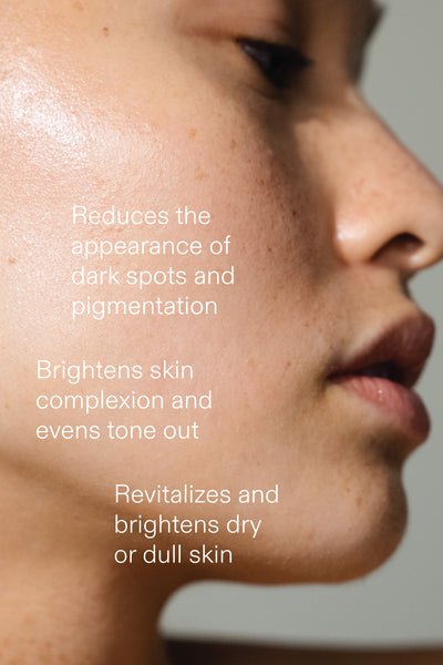 Dark Spots & Pigmentation Serum